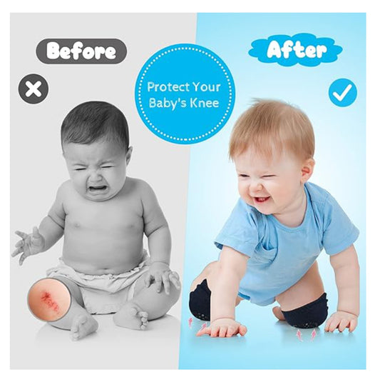 BabyKnee™ Rodilleras Antideslizantes para Bebés